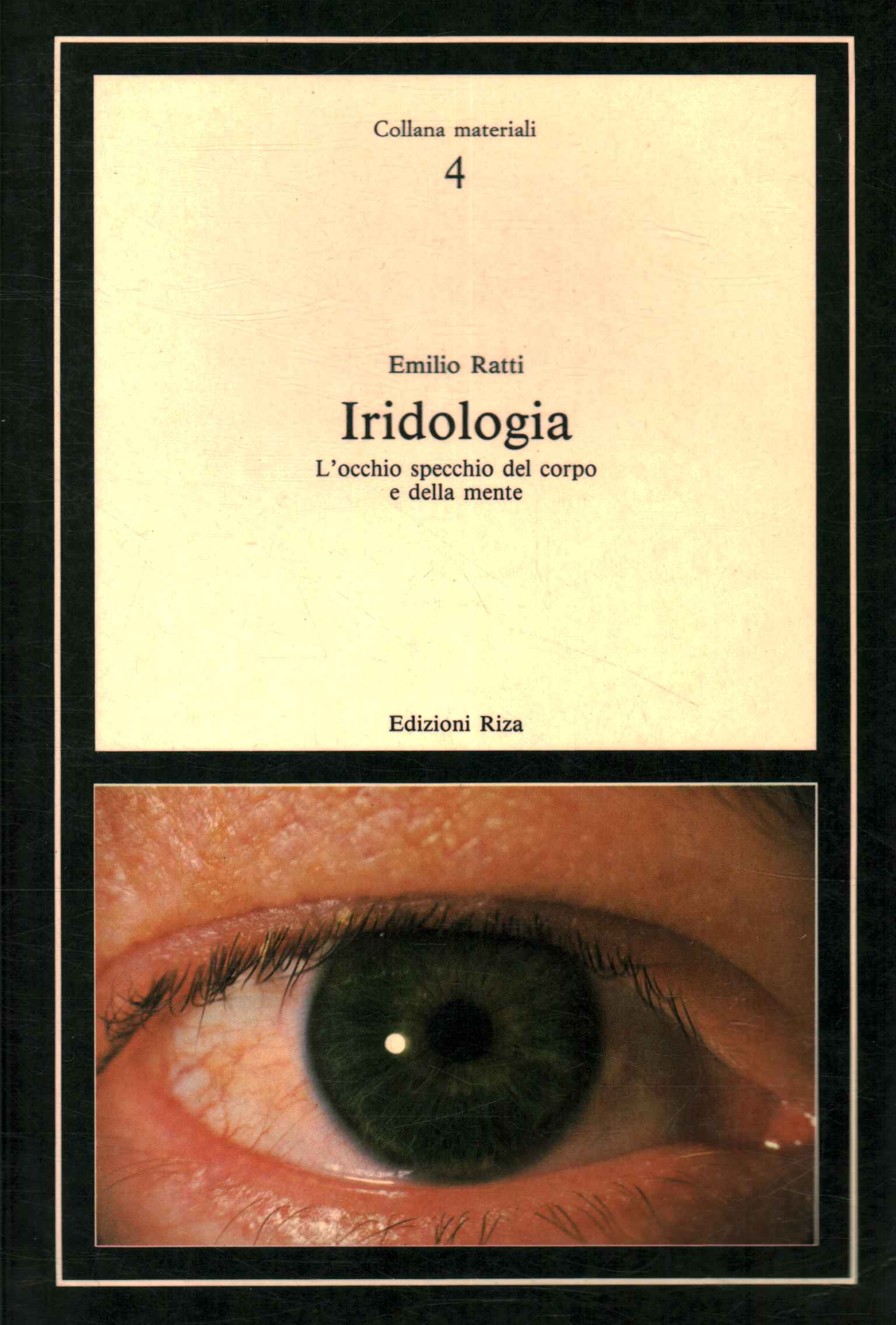 Iridology